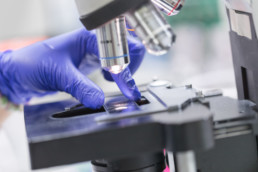 macrobiopsie sous tomosynthèse à paris