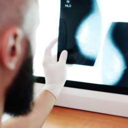 mammographie paris